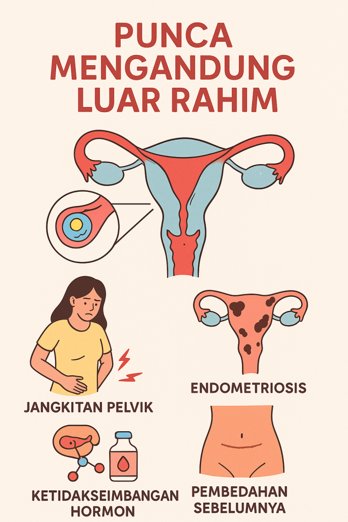 tanda mengandung luar rahim